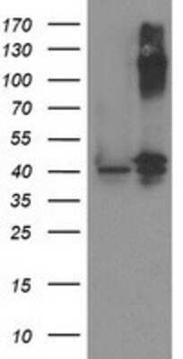 Western Blot: PANK3 Antibody (3C4) [NBP2-03298] HEK293T cells were transfected with the pCMV6-ENTRY control (Left lane) or pCMV6-ENTRY PANK3 (Right lane) cDNA for 48 hrs and lysed. Equivalent amounts of cell lysates (5 ug per lane) were separated by SDS-PAGE and immunoblotted with anti-PANK3.