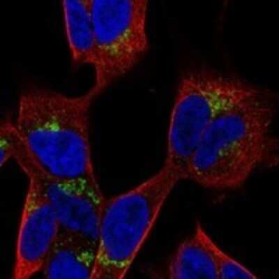 Immunocytochemistry/Immunofluorescence: PANK3 Antibody [NBP3-17749] - Staining of human cell line SH-SY5Y shows localization to the Golgi apparatus.