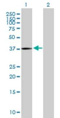 Western Blot: PANK3 Antibody [H00079646-B01P] - Analysis of PANK3 expression in transfected 293T cell line by PANK3 polyclonal antibody.  Lane 1: PANK3 transfected lysate(40.7 KDa). Lane 2: Non-transfected lysate.