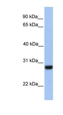 Western Blot: PAOX Antibody [NBP1-70666] - Human Muscle lysate, concentration 0.2-1 ug/ml.