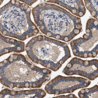 Immunohistochemistry-Paraffin PAP2 Antibody - BSA Free
