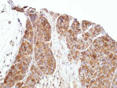 Immunohistochemistry-Paraffin: PAP39 Antibody [NBP1-32625] - Paraffin-embedded SW480 xenograft, using antibody at 1:500 dilution.