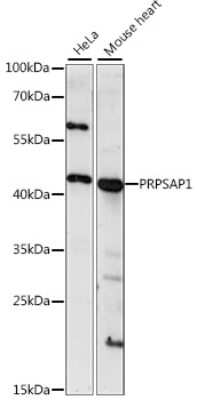 Western Blot: PAP39 Antibody [NBP2-93395] - Analysis of extracts of various cell lines, using PAP39 at 1:1000 dilution. Secondary antibody: HRP Goat Anti-Rabbit IgG (H+L) at 1:10000 dilution. Lysates/proteins: 25ug per lane. Blocking buffer: 3% nonfat dry milk in TBST. Detection: ECL Basic Kit . Exposure time: 30s.