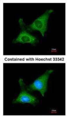 Immunocytochemistry/Immunofluorescence: PAPD1 Antibody [NBP2-19690] -  Analysis of methanol-fixed HeLa, using Mt PAP(GTX118738) antibody at 1:200 dilution.