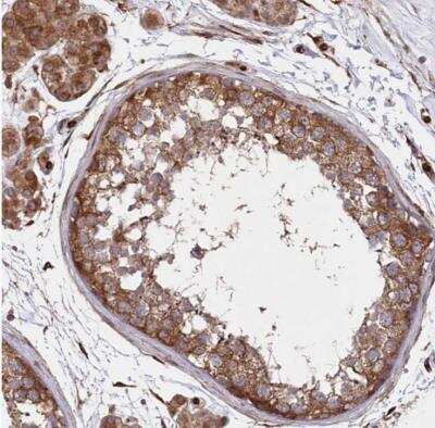 Immunohistochemistry-Paraffin: PAPD1 Antibody [NBP1-83856] - Staining of human testis shows strong cytoplasmic positivity in cells in seminiferous ducts and Leydig cells).