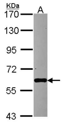 Western Blot: PAPD1 Antibody [NBP2-19689] - Sample (30 ug of whole cell lysate) A: HCT116 7. 5% SDS PAGE gel, diluted at 1:3000.