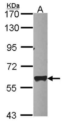 Western Blot: PAPD1 Antibody [NBP2-19690] - Sample (30 ug of whole cell lysate) A: HCT116 7. 5% SDS PAGE gel, diluted at 1:5000.