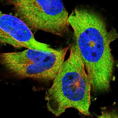 Immunocytochemistry/Immunofluorescence: PAPD4 Antibody [NBP2-58551] - Staining of human cell line U-251 MG shows localization to cytosol.