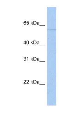 Western Blot: PAPD4 Antibody [NBP1-53057] - MCF-7 whole cell lysates, concentration 0.2-1 ug/ml.