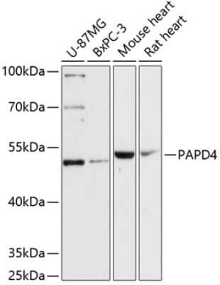 Western Blot: PAPD4 Antibody [NBP2-93923] - Analysis of extracts of various cell lines, using PAPD4 at 1:3000 dilution.Secondary antibody: HRP Goat Anti-Rabbit IgG (H+L) at 1:10000 dilution.Lysates/proteins: 25ug per lane.Blocking buffer: 3% nonfat dry milk in TBST.Detection: ECL Basic Kit .Exposure time: 90s.