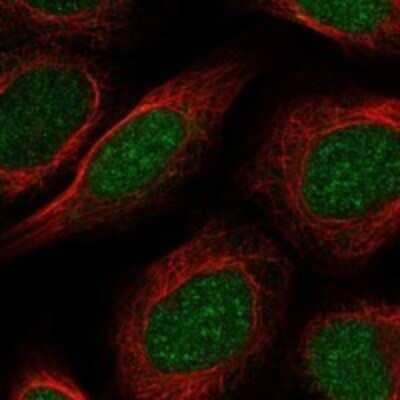 Immunocytochemistry/Immunofluorescence: PAPOLB Antibody [NBP3-17409] - Staining of human cell line U-2 OS shows localization to nucleoplasm.