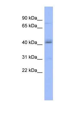 Western Blot: PAPOLB Antibody [NBP1-57561] - COLO205 cells lysate, concentration 0.2-1 ug/ml.