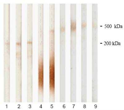 Western Blot: PAPP A Antibody (3C8) [NB200-403] - Detection of human PAPP-A and proMBP subunits of  htPAPP-A by monoclonal antibodies in Western blotting.  Lane 1: 18A10 (NB100-73059)  Lane 2: 7A6 (NB100-73060)  Lane 3: 3C8 (NB200-402)  Lane 4: 5H9 (proMBP-specific) (NB110-8423)  Lane 5: 11E4 (proMBP-specific) (NB120-14597)  Lane 6: 7A6 (NB100-73060)  Lane 7: 10A5 (NB200-402)  Lane 8: 3C8 (NB200-403)  Lane 9: 10E1 (NB120-8346)  Lanes 1-5: after SDS-PAGE in reduction conditions.  Lanes 6-9: Non-reducing conditions. Heterotetrameric complex was detected  by anti-PAPP-A MAbs