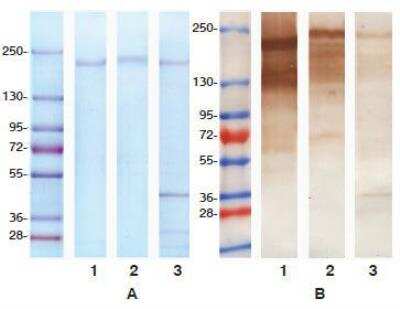 Western Blot: PAPP A Antibody (3C8) [NB200-403] - Figure A - SDS-PAGE analysis in reducing conditions of human recombinant  dPAPP-A and tissue (purified from atherosclerotic plaques) dPAPP-A.  Lane 1: human htPAPP-A   Lane 2: recombinant dPAPP-A  Lane 3: tissue dPAPP-A   Gel staining: Coomassie brilliant blue R-250  Comments: proMBP subunit released from htPAPP-A upon reduction is not  stained by Coomassie brilliant blue because of high degree of glycosylation.  Figure B - Western blotting analysis of PAPP-A purified from atherosclerotic  tissue. For immunostaining mixture of anti-PAPP-A MAbs 18A10 (Cat # NB100-73059), 7A6(Cat # NB100-73060)  and 3C8 (Cat # NB200-403) Lanes are noted as in Figure A.
