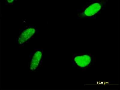 Immunocytochemistry/Immunofluorescence: PAPSS2 Antibody [H00009060-B01P] - Analysis of purified antibody to PAPSS2 on HeLa cell. (antibody concentration 10 ug/ml)