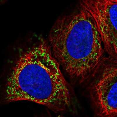 Immunocytochemistry/Immunofluorescence: PAPSS2 Antibody [NBP2-56643] - Staining of human cell line U-2 OS shows localization to mitochondria.