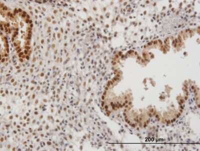 Immunohistochemistry-Paraffin: PAPSS2 Antibody [H00009060-B01P] - Analysis of purified antibody to PAPSS2 on formalin-fixed paraffin-embedded human endometrium. (antibody concentration 3 ug/ml)