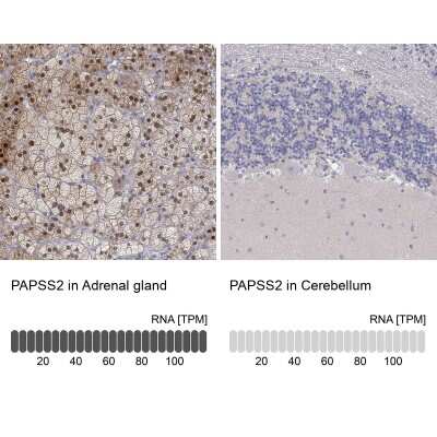 Immunohistochemistry-Paraffin: PAPSS2 Antibody [NBP3-17062] - Analysis in human adrenal gland and cerebellum tissues using Anti-PAPSS2 antibody. Corresponding PAPSS2 RNA-seq data are presented for the same tissues.