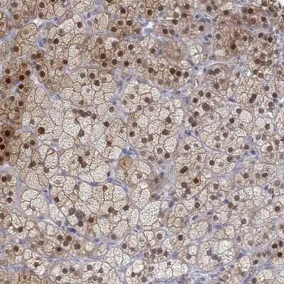 Immunohistochemistry-Paraffin: PAPSS2 Antibody [NBP3-17062] - Staining of human adrenal gland shows high expression.