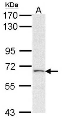 Western Blot: PAPSS2 Antibody [NBP1-33726] - Sample (30 ug of whole cell lysate) A: Hela 7. 5% SDS PAGE; antibody diluted at 1:1000.