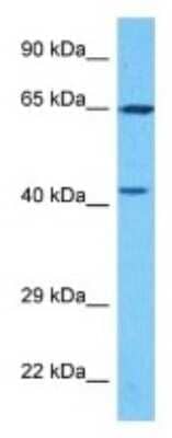 Western Blot: PAPSS2 Antibody [NBP3-09946] - Western blot analysis of PAPSS2 in MCF7 Whole Cell lysates. Antibody dilution at 1.0ug/ml