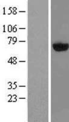 Western Blot: PAPSS2 Overexpression Lysate (Adult Normal) [NBL1-14096] Left-Empty vector transfected control cell lysate (HEK293 cell lysate); Right -Over-expression Lysate for PAPSS2.