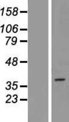 Western Blot PAQR5 Overexpression Lysate