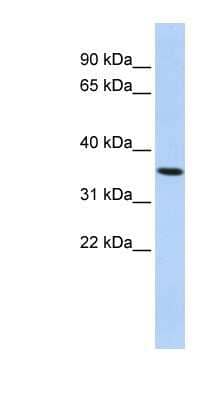 Western Blot: PAQR6 Antibody [NBP1-59477] - HepG2 cell lysate, concentration 0.2-1 ug/ml.