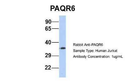 Western Blot: PAQR6 Antibody [NBP1-59477] - Jurkat, Antibody Dilution: 1.0 ug/ml PAQR6 is supported by BioGPS gene expression data to be expressed in Jurkat.