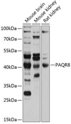 Western Blot: PAQR8 Antibody [NBP2-93893] - Analysis of extracts of various cell lines, using PAQR8 at 1:1000 dilution.Secondary antibody: HRP Goat Anti-Rabbit IgG (H+L) at 1:10000 dilution.Lysates/proteins: 25ug per lane.Blocking buffer: 3% nonfat dry milk in TBST.Detection: ECL Basic Kit .Exposure time: 10s.