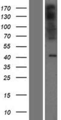 Western Blot: PAQR9 Overexpression Lysate (Adult Normal) [NBP2-04689] Left-Empty vector transfected control cell lysate (HEK293 cell lysate); Right -Over-expression Lysate for PAQR9.