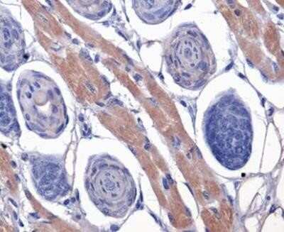 Immunohistochemistry: PAR1/Thrombin Receptor Antibody (N2-11) - Azide and BSA Free [NBP2-80904] - Analysis of Thrombin Receptor on mouse skin using NBP1-71770. Image from the standard format of this antibody.