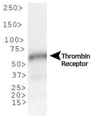 Western Blot: PAR1/Thrombin Receptor Antibody (N2-11) - Azide and BSA Free [NBP2-80904] - Analysis of Thrombin Receptor expression in human testis using NBP1-71770. Image from the standard format of this antibody.