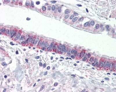 Immunohistochemistry-Paraffin: PAR4 Antibody [NLS1308] - Analysis of anti-F2RL3 / PAR4 antibody with human lung, respiratory epithelium.