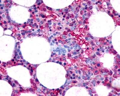 Immunohistochemistry-Paraffin: PAR4 Antibody [NLS1310] - Analysis of anti-F2RL3 / PAR4 antibody with human bone marrow at 2 ug/ml.