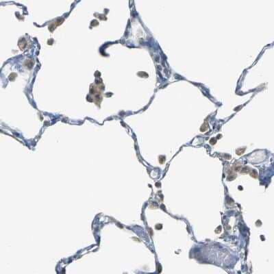 Immunohistochemistry-Paraffin: PARD6B Antibody [NBP1-87337] - Staining of human lung shows moderate cytoplasmic positivity in macrophages.