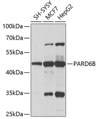 Western Blot: PARD6B Antibody [NBP2-93357] - Analysis of extracts of various cell lines, using PARD6B at 1:1000 dilution.Secondary antibody: HRP Goat Anti-Rabbit IgG (H+L) at 1:10000 dilution.Lysates/proteins: 25ug per lane.Blocking buffer: 3% nonfat dry milk in TBST.Detection: ECL Basic Kit .Exposure time: 5s.