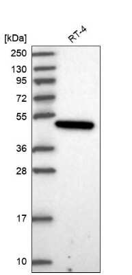 Western Blot: PARD6G Antibody [NBP2-30757] - Analysis in human cell line RT-4.