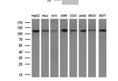 Western Blot: PARG Antibody (OTI6F4) - Azide and BSA Free [NBP2-73245] - Analysis of extracts (10ug) from 8 different cell lines by using anti-PARG monoclonal antibody.(1:200