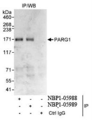 Immunoprecipitation: PARG1 Antibody [NBP1-05988] - Whole cell lysate (1 mg for IP,  20% of IP loaded) from HeLa cells. Antibodies: Affinity purified  rabbit anti-PARG1 antibody used for IP at 3 mcg/mg  lysate.
