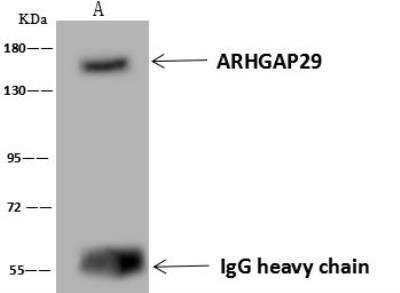 Immunoprecipitation: PARG1 Antibody [NBP3-12573] - Lane A:0.5 mg HeLa Whole Cell Lysate4 uL anti-ARHGAP29 rabbit polyclonal antibody and 60 ug of Immunomagnetic beads Protein A/G.Primary antibody:Anti-ARHGAP29 rabbit polyclonal antibody,at 1:100 dilution Secondary antibody:Goat Anti-Rabbit IgG (H+L)/HRP at 1/10000 dilutionDeveloped using the ECL technique.Performed under reducing conditions.Predicted band size: 142 kDaObserved band size :171 kDa