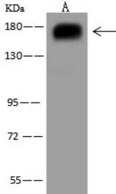 Western Blot: PARG1 Antibody [NBP3-12573] - Lane A: HeLa Whole Cell LysateLysates/proteins at 30 ug per lane.SecondaryGoat Anti-Rabbit IgG (H+L)/HRP at 1/10000 dilution.Developed using the ECL technique.Performed under reducing conditions.Predicted band size:142 kDaObserved band size:170 kDa