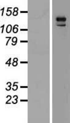 Western Blot: PARG1 Overexpression Lysate (Adult Normal) [NBL1-07670] Left-Empty vector transfected control cell lysate (HEK293 cell lysate); Right -Over-expression Lysate for PARG1.
