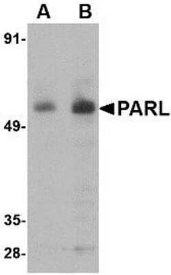 Western Blot: PARL Antibody [NBP1-76938] - 3T3 cell lysate with PARL antibody at (A) 1 and (B) 2 ug/ml.