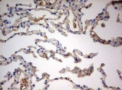 Immunohistochemistry: PARN Antibody (4D12) [NBP2-46321] - Analysis of Human lung tissue. (Heat-induced epitope retrieval by 10mM citric buffer, pH6.0, 120C for 3min)