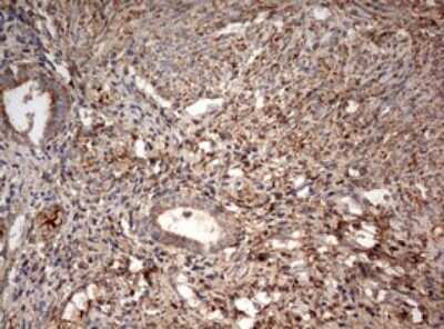 Immunohistochemistry: PARN Antibody (4D12) [NBP2-46321] - Analysis of Human endometrium tissue. (Heat-induced epitope retrieval by 10mM citric buffer, pH6.0, 120C for 3min)