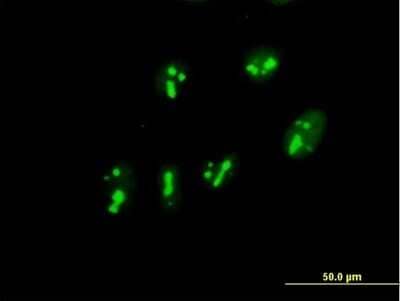 Immunocytochemistry/Immunofluorescence: PARN Antibody [H00005073-B01P] - Analysis of purified antibody to PARN on HeLa cell. (antibody concentration 10 ug/ml)