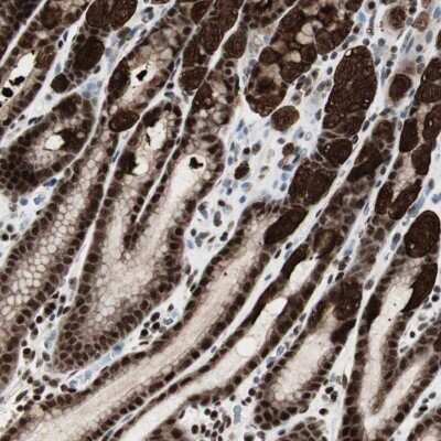 Immunohistochemistry-Paraffin: PARN Antibody [NBP1-84302] - Staining of human stomach shows strong nuclear and cytoplasmic positivity in glandular cells.