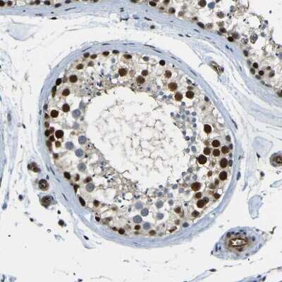 Immunohistochemistry-Paraffin: PARN Antibody [NBP1-84303] - Staining of human testis shows high expression.