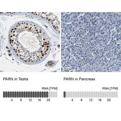 <b>Orthogonal Strategies Validation. </b>Immunohistochemistry-Paraffin: PARN Antibody [NBP1-84303] - Staining in human testis and pancreas tissues using anti-PARN antibody. Corresponding PARN RNA-seq data are presented for the same tissues.